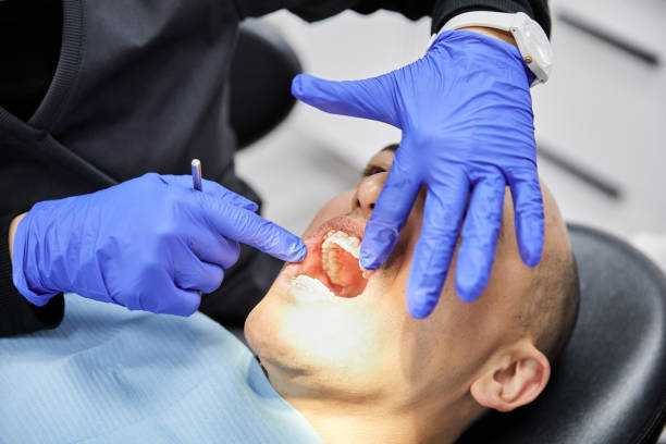 Best Emergency Dental Care for Broken or Chipped Teeth in Bloomingdale, NJ